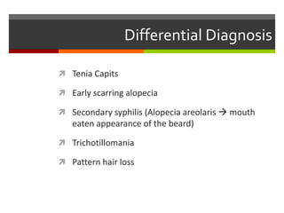 Differential Diagnosis
 Tenia Capits
 Early scarring alopecia
 Secondary syphilis (Alopecia areolaris  mouth
eaten appearance of the beard)
 Trichotillomania
 Pattern hair loss
 