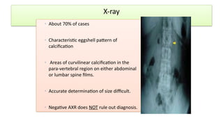 Abdominal aortic aneurysm vascular surgery | PPTX