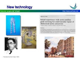 http://www.perfuse.netVascular surgery @ Tallaght
New technologyNew technology
Parodi et al Ann Vasc 1991
 