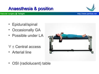 http://www.perfuse.netVascular surgery @ Tallaght
Anaesthesia & positionAnaesthesia & position
• Epidural/spinal
• Occasionally GA
• Possible under LA
∀ ± Central access
• Arterial line
• OSI (radiolucent) table
 