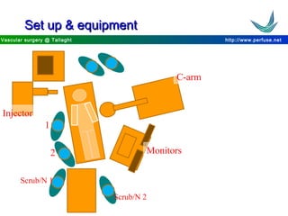 http://www.perfuse.netVascular surgery @ Tallaght
Set up & equipmentSet up & equipment
1
2
Scrub/N 1
C-arm
Monitors
Injector
Scrub/N 2
 