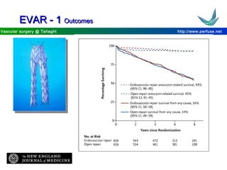 http://www.perfuse.netVascular surgery @ Tallaght
EVAR - 1EVAR - 1 OutcomesOutcomes
 