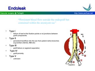 http://www.perfuse.netVascular surgery @ Tallaght
EndoleakEndoleak
“Persistent blood flow outside the endograft but
contained within the aneurysm sac”
• Type I
– failure of seal at the fixation points or at junctions between
graft components
• Type II
– persistent backflow into the sac from patent native branches
(e.g lumbar arteries, IMA etc)
• Type III
– graft failure or segment separation
• Type IV
– graft porosity
• Type V
– unknown
 