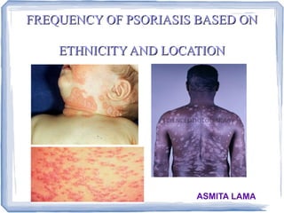 FREQUENCY OF PSORIASIS BASED ON

    ETHNICITY AND LOCATION




                      ASMITA LAMA
 