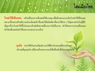 ยุงกัด ก่อนใช้ครีมทาแก้ยุงกัด ลองใช้ด้านในของเปลือกกล้วยทา
บริเวณที่ถูกยุงกัด เปลือกกล้วยสามารถแก้เม็ดผื่นคันที่เกิดจากยุงกัดได้
โรคลาไส้เป็นแผล กล้วยเป็นอาหารที่แพทย์ใช้ควบคุม เพื่อต้านทานการเกิดโรคลาไส้เป็นแผล
เพราะเนื้อของกล้วยมีความอ่อนนิ่มพอดี เป็นผลไม้ชนิดเดียวที่ทานได้ง่าย ๆ ไม่ยุ่งยากสาหรับผู้ที่มี
ปัญหาเรื่องโรคลาไส้เรื้อรังและกล้วยยังมีสภาพเป็นกลางไม่เป็นกรด ทาให้ลดการระคายเคืองและ
ยังไปเคลือบผนังลาไส้และกระเพาะอาหารด้วย
 