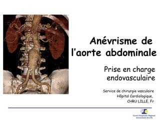 Anévrisme de
l’aorte abdominale
Prise en charge
endovasculaire
Service de chirurgie vasculaire
Hôpital Cardiologique,
CHRU LILLE, Fr
 
