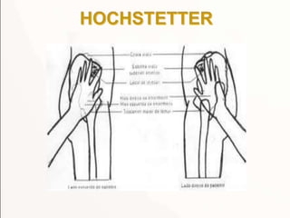 HOCHSTETTER
 