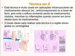 Técnica em Z
• Está técnica é muito usada em aplicações intramusculares de
medicamentos oleosos (ex.: anticoncepcionais) ou a base de
ferro, pois evita o refluxo (evitando perda de medicamento),
nódulos, manchas ou inflamações quando ocorrer em torno
destes tipos de medicamentos.
• O locais ideais para realizar esta técnica é a região dorso-
glútea ou ventroglútea
 