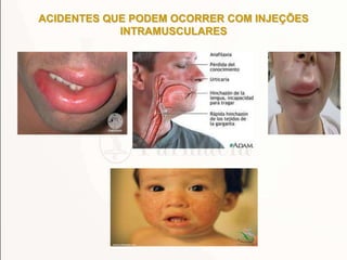 ACIDENTES QUE PODEM OCORRER COM INJEÇÕES
INTRAMUSCULARES
 