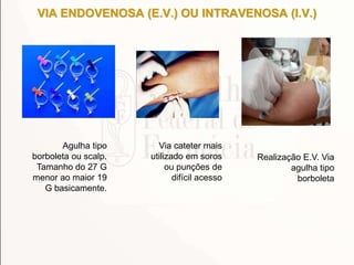 VIA ENDOVENOSA (E.V.) OU INTRAVENOSA (I.V.)
Agulha tipo
borboleta ou scalp.
Tamanho do 27 G
menor ao maior 19
G basicamente.
Via cateter mais
utilizado em soros
ou punções de
difícil acesso
Realização E.V. Via
agulha tipo
borboleta
 