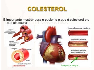 COLESTEROL
É importante mostrar para o paciente o que é colesterol e o
que ele causa
Coágulo de sangue
 