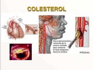 COLESTEROL
 