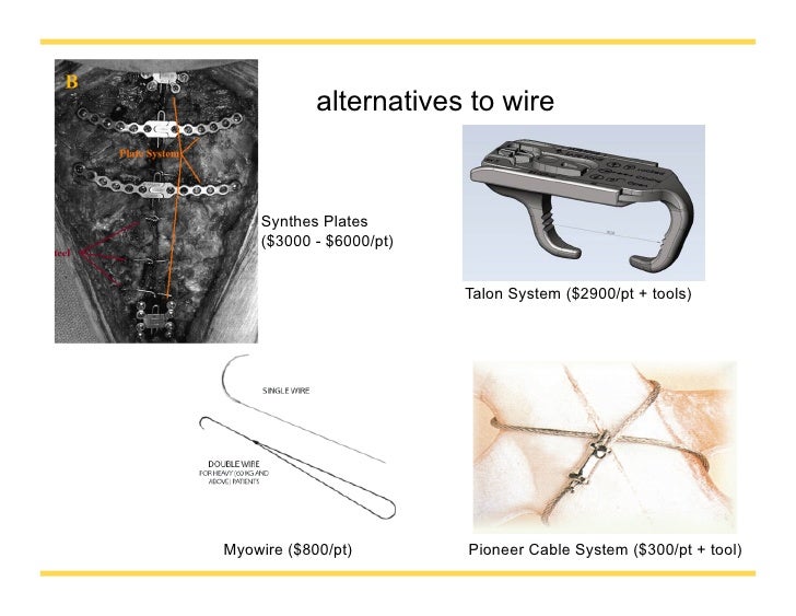 Pioneer Sternal Cable System Surgical Instrumentation Tray 400 456 Wire Crimp Ebay