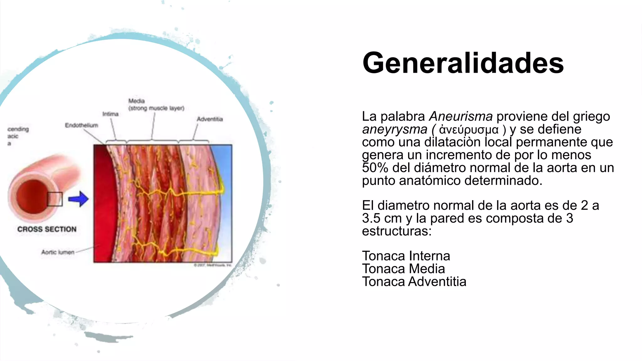 Aneurisma Aòrtico | PPT