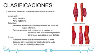 Aneurisma Aòrtico | PPTX