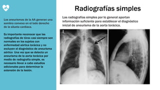 Aneurisma Aòrtico | PPTX