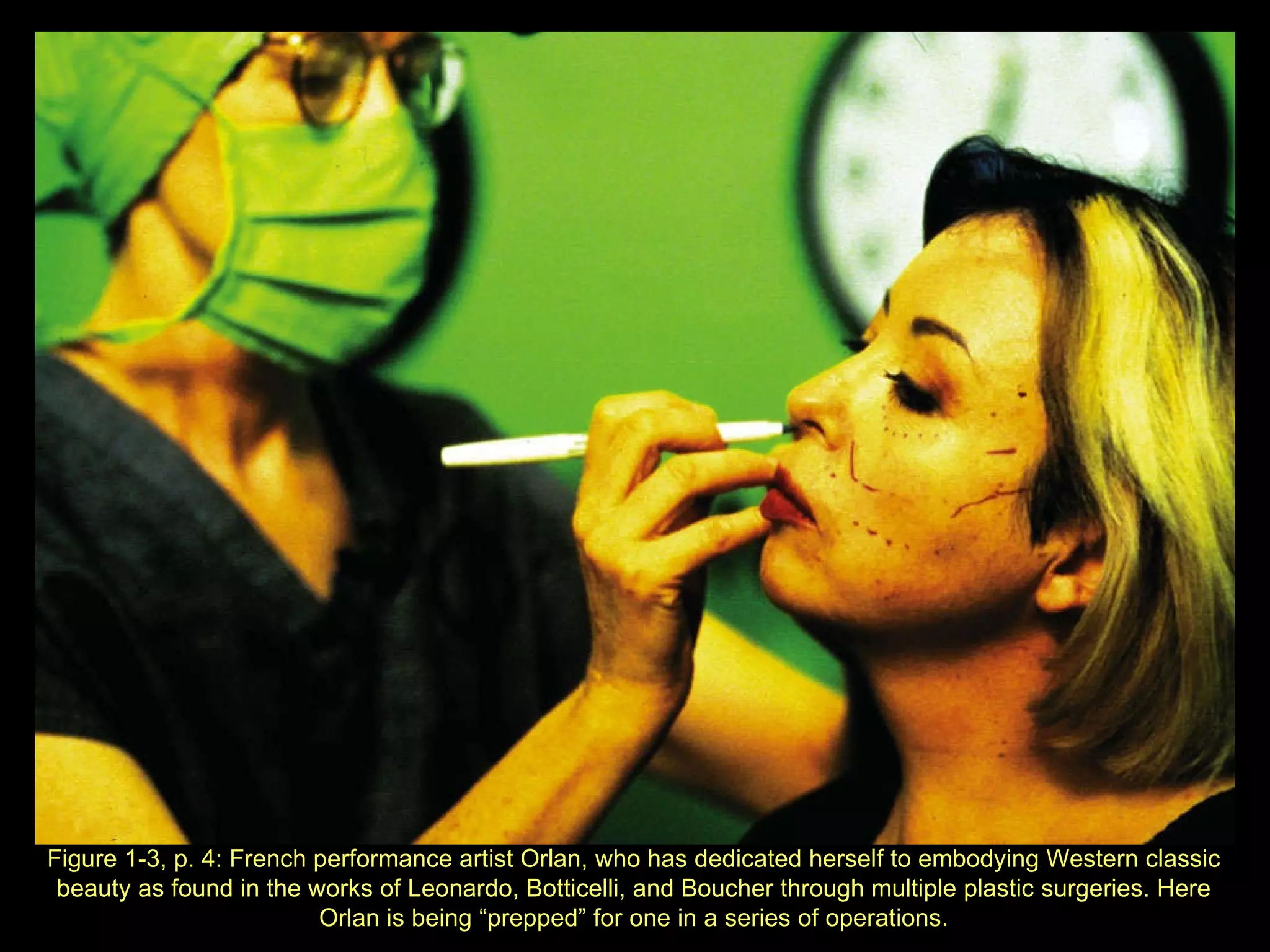 Figure 1 - 3, p. 4: French performance artist Orlan, who has dedicated herself to embodying Western classic beauty as found in the works of Leonardo, Botticelli, and Boucher through multiple plastic surgeries. Here Orlan is being “prepped” for one in a series of operations. 