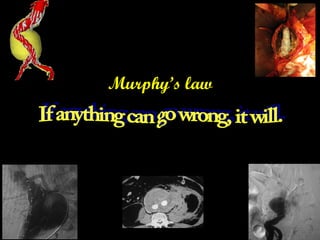 Murphy’s law
 