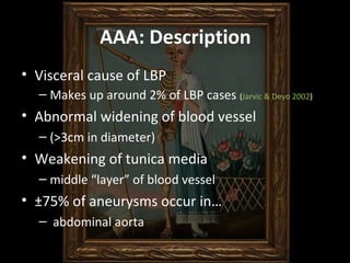 AAA: Description
• Visceral cause of LBP
– Makes up around 2% of LBP cases (Jarvic & Deyo 2002)
• Abnormal widening of blo...