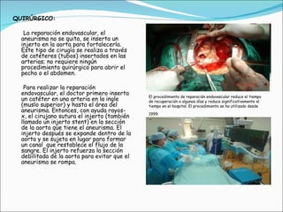 QUIRÚRGICO: La reparación endovascular, el aneurisma no se quita, se inserta un injerto en la aorta para fortalecerla. Este tipo de cirugía se realiza a través de catéteres (tubos) insertados en las arterias; no requiere ningún procedimiento quirúrgico para abrir el pecho o el abdomen.   Para realizar la reparación endovascular, el doctor primero inserta un catéter en una arteria en la ingle (muslo superior) y hasta el área del aneurisma. Entonces, con ayuda rayos- x, el cirujano sutura el injerto (también llamado un injerto stent) en la sección de la aorta que tiene el aneurisma. El injerto después se expande dentro de la aorta y se sujeta en lugar para formar un canal  que restablece el flujo de la sangre. El injerto refuerza la sección debilitada de la aorta para evitar que el aneurisma se rompa.   El procedimiento de reparación endovascular reduce el tiempo de recuperación a algunos días y reduce significativamente el tiempo en el hospital. El procedimiento se ha utilizado desde 1999.   