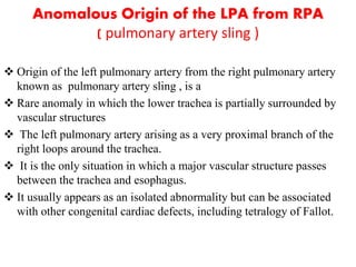 aortic arch anamolies | PPTX