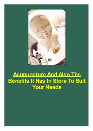 Acupuncture And Also The
Benefits It Has In Store To Suit
Your Needs

 
