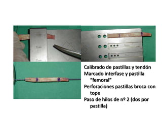 Calibrado de pastillas y tendón
Marcado interfase y pastilla
  “femoral”
Perforaciones pastillas broca con
  tope
Paso de hilos de nº 2 (dos por
  pastilla)
 