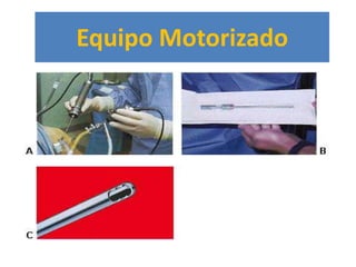 Equipo Motorizado
 