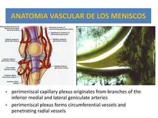 ANATOMIA VASCULAR DE LOS MENISCOS




•   perimeniscal capillary plexus originates from branches of the
    inferior medial and lateral geniculate arteries
•   perimeniscal plexus forms circumferential vessels and
    penetrating radial vessels
 