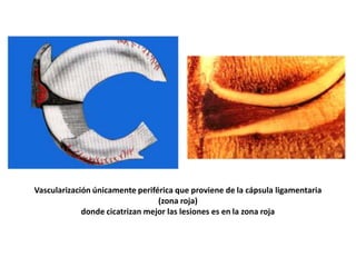 Vascularización únicamente periférica que proviene de la cápsula ligamentaria
                                 (zona roja)
             donde cicatrizan mejor las lesiones es en la zona roja
 