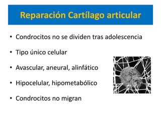 Reparación Cartílago articular

• Condrocitos no se dividen tras adolescencia

• Tipo único celular

• Avascular, aneural, alinfático

• Hipocelular, hipometabólico

• Condrocitos no migran
 