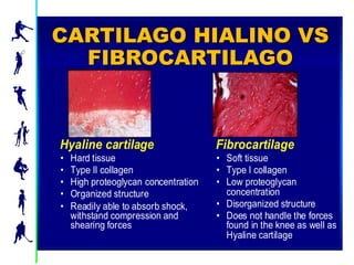 CARTILAGO HIALINO VS
    FIBROCARTILAGO
 Hyaline Cartilage vs. Fibrocartilage




 Hyaline cartilage                     Fibrocartilage
 •   Hard tissue                       • Soft tissue
 •   Type II collagen                  • Type I collagen
 •   High proteoglycan concentration   • Low proteoglycan
 •   Organized structure                 concentration
 •   Readily able to absorb shock,     • Disorganized structure
     withstand compression and         • Does not handle the forces
     shearing forces                     found in the knee as well as
                                         Hyaline cartilage
                                                                 66032.A
                                                                 06/2002
 
