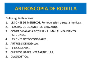 ARTROSCOPIA DE RODILLA
En los siguientes casos:
1. LESIONES DE MENISCOS. Remodelación o sutura meniscal.
2. PLASTIAS DE LIGAMENTOS CRUZADOS.
3. CONDROMALACIA ROTULIANA. MAL ALINEAMIENTO
    ROTULIANO.
4. LESIONES OSTEOCONDRALES.
5. ARTROSIS DE RODILLA.
6. PLICA SINOVIAL
7. CUERPOS LIBRES INTRAARTICULAR.
8. DIAGNOSTICA.
 