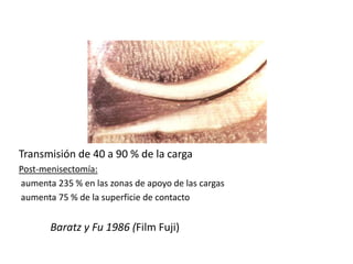 Amortiguador




Transmisión de 40 a 90 % de la carga
Post-menisectomía:
aumenta 235 % en las zonas de apoyo de las cargas
aumenta 75 % de la superficie de contacto


       Baratz y Fu 1986 (Film Fuji)
 