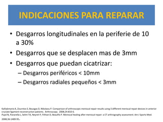 INDICACIONES PARA REPARAR
        • Desgarros longitudinales en la periferie de 10
          a 30%
        • Desgarros que se desplacen mas de 3mm
        • Desgarros que puedan cicatrizar:
                – Desgarros periféricos < 10mm
                – Desgarros radiales pequeños < 3mm



Kalliakmanis A, Zourntos S, Bousgas D, Nikolaou P. Comparison of arthroscopic meniscal repair results using 3 different meniscal repair devices in anterior
cruciate ligament reconstruction patients. Arthroscopy. 2008;24:810-6.
Pujol N, Panarella L, Selmi TA, Neyret P, Fithian D, Beaufils P. Meniscal healing after meniscal repair: a CT arthrography assessment. Am J Sports Med.
2008;36:1489-95   .
 