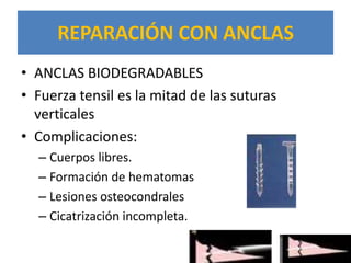 REPARACIÓN CON ANCLAS
• ANCLAS BIODEGRADABLES
• Fuerza tensil es la mitad de las suturas
  verticales
• Complicaciones:
  – Cuerpos libres.
  – Formación de hematomas
  – Lesiones osteocondrales
  – Cicatrización incompleta.
 