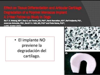 • El implante NO
    previene la
  degradación del
      cartílago.
 