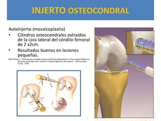 INJERTO OSTEOCONDRAL
Autoinjerto (mosaicoplastia)
• Cilindros osteocondrales extraídos
    de la cara lateral del cóndilo femoral
    de 2 x2cm.
• Resultados buenos en lesiones
    pequeñas.
MATSUSUE Y. ”Arthoscopy multiple osteocondral transplantation to the condral defect in
       the knee associate with anterior cruciate ligament disruption” Arthroscopy
       9:318, 1993
 