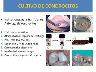 CULTIVO DE CONDROCITOS

• Indicaciones para Transplante
  Autologo de condrocitos:

1.   Lesiones sintomaticas
2.   Afectan todo el espesor del cartilago
3.   Pac. Entre 15 y 55 años
4.   Lesiones III y IV de Outerbridge
5.   Osteocondritis discecante
6.   No desviaciones varo-valgo
7.   Contensión y soporte del defecto
 