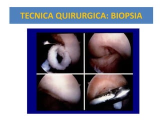 TECNICA QUIRURGICA: BIOPSIA
   Surgical Technique- Biopsy




                                66032.A
                                06/2002
 