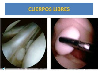 CUERPOS LIBRES
 