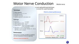 WORKSHOP EMG Electroneuromyography EP.pptx