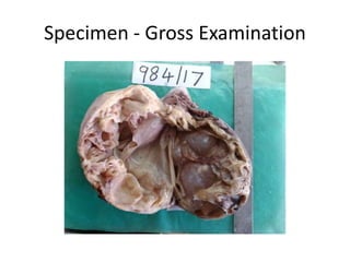 Specimen - Gross Examination
 