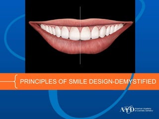 PRINCIPLES OF SMILE DESIGN-DEMYSTIFIED
 