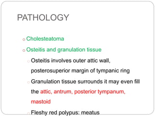 PATHOLOGY
o Cholesteatoma
o Osteitis and granulation tissue
o Osteitis involves outer attic wall,
posterosuperior margin of tympanic ring
o Granulation tissue surrounds it may even fill
the attic, antrum, posterior tympanum,
mastoid
o Fleshy red polypus: meatus
 