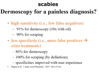 scabies 
