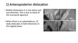 1) Anteroposterior dislocation
• Mobile dislocation is in one plane and
one direction. This is due to laxity of
the transverse ligament.
• When there is os odontoideum, C2
body dislocates in both directions in
the sagittal plane
 