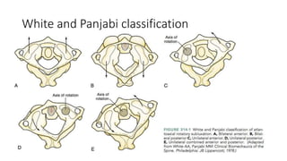 White and Panjabi classification
 