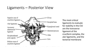 Ligaments – Posterior View
The most critical
ligaments to evaluate
for stability in the CVJ
are the transverse
ligament of the
cruciform complex, the
alar ligaments, and the
tectorial membrane
 