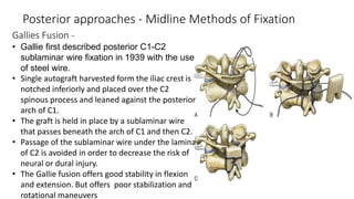 Gallies Fusion -
• Gallie first described posterior C1-C2
sublaminar wire fixation in 1939 with the use
of steel wire.
• Single autograft harvested form the iliac crest is
notched inferiorly and placed over the C2
spinous process and leaned against the posterior
arch of C1.
• The graft is held in place by a sublaminar wire
that passes beneath the arch of C1 and then C2.
• Passage of the sublaminar wire under the lamina
of C2 is avoided in order to decrease the risk of
neural or dural injury.
• The Gallie fusion offers good stability in flexion
and extension. But offers poor stabilization and
rotational maneuvers
Posterior approaches - Midline Methods of Fixation
 